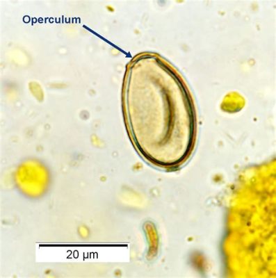  Metorchis! A Tiny Trematode That Calls Your Fish Dinner Home