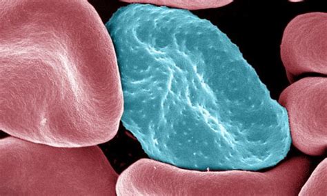  Plasmodium: The Microscopic Mastermind Behind Malaria -  A Tiny Terror Capable of Triggering Tremendous Trouble!