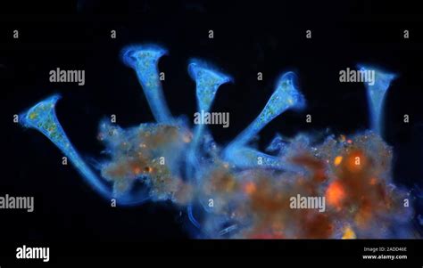  Stentor!  A Tiny Trumpet-Playing Ciliate That Thrives on Sunlight and Bacteria